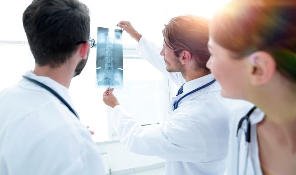 A méhnyak osteokondrózis diagnosztizálása